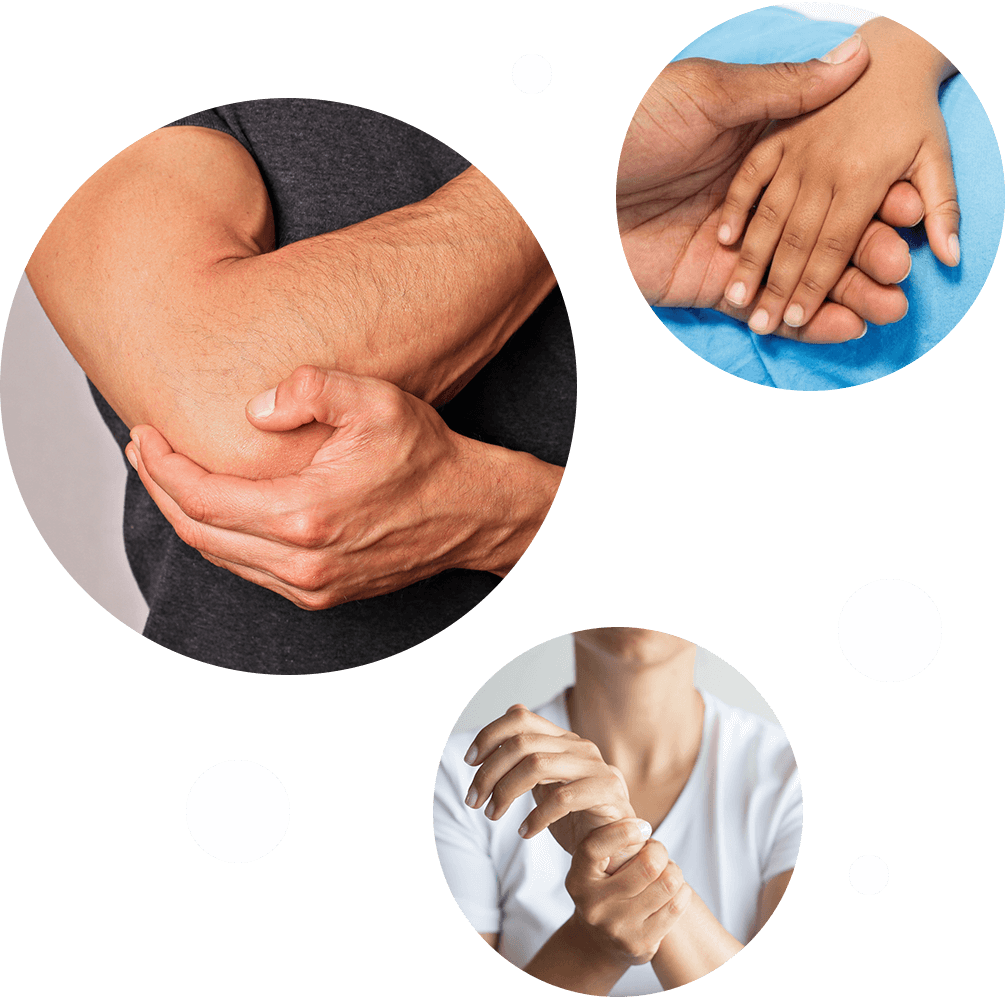 Skilled Hand Therapists for variety of conditions that affect the upper limb